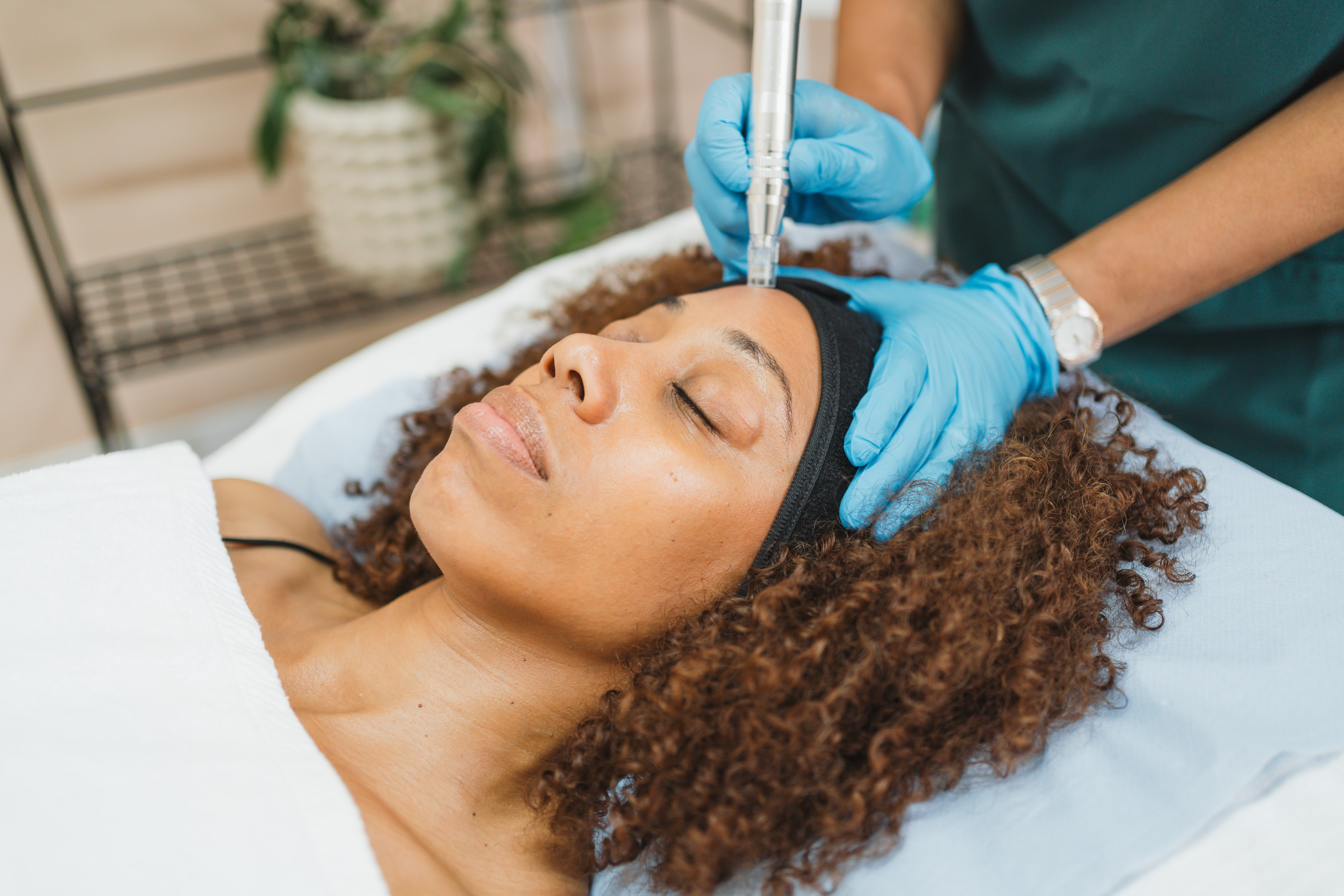 Microneedling for Skin